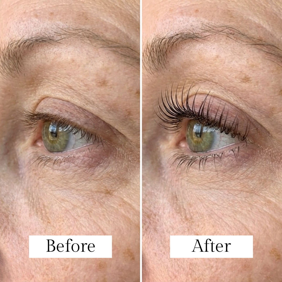 Lunōra Lash Elixir™